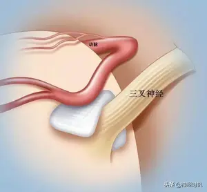 体表神经解剖：三叉神经详解