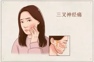 三叉神经痛？这些方法助您摆脱困扰