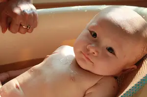 想告别湿疹:这些养生技巧教你如何防止湿疹复发让你的肌肤健康亮丽