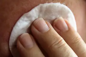拜拜痘痘:欢迎水嫩肌肤DIY祛痘小技巧盘点