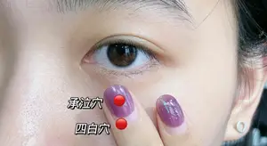 如何去除眼角细纹？ 眼角细纹怎么消除？