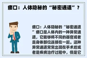 瘘口：人体隐秘的“秘密通道”？