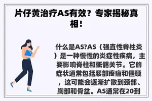 片仔黄治疗AS有效？专家揭秘真相！
