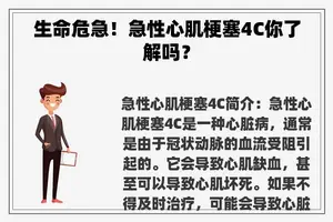 生命危急！急性心肌梗塞4C你了解吗？