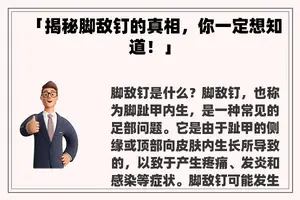 「揭秘脚敌钉的真相,你一定想知道!」 「揭秘脚敌钉的真相,你一定想知道!」