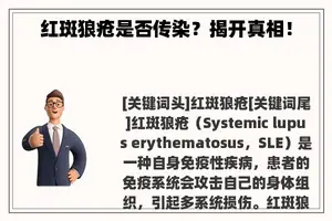 红斑狼疮是否传染？揭开真相！