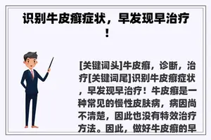 识别牛皮癣症状，早发现早治疗！