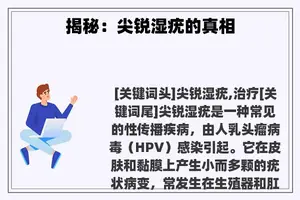 揭秘：尖锐湿疣的真相