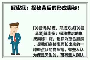 解密痣：探秘背后的形成奥秘！