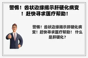 警惕！齿状边缘揭示肝硬化病变！赶快寻求医疗帮助！
