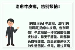 治愈牛皮癣，告别烦恼！