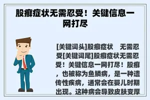 股癣症状无需忍受！关键信息一网打尽