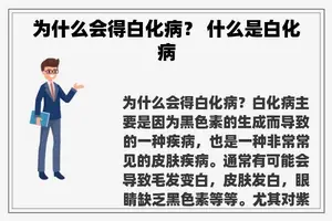 为什么会得白化病？ 什么是白化病