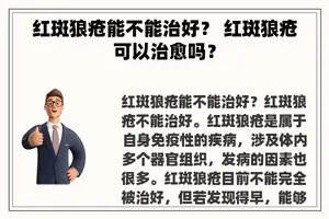 红斑狼疮能不能治好？ 红斑狼疮可以治愈吗？