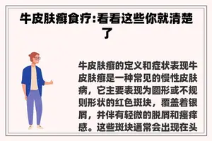 牛皮肤癣食疗:看看这些你就清楚了