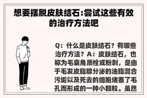 想要摆脱皮肤结石:尝试这些有效的治疗方法吧