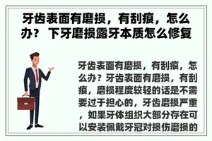 牙齿表面有磨损，有刮痕，怎么办？ 下牙磨损露牙本质怎么修复？