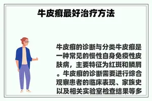 牛皮癣最好治疗方法