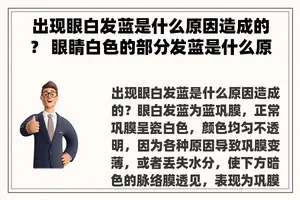 出现眼白发蓝是什么原因造成的？ 眼睛白色的部分发蓝是什么原因？