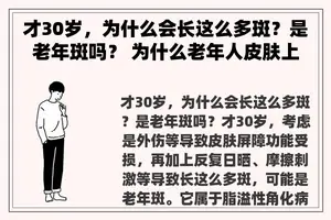 才30岁，为什么会长这么多斑？是老年斑吗？ 为什么老年人皮肤上会长老年斑？