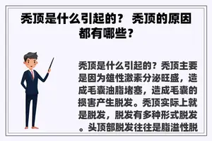 秃顶是什么引起的？ 秃顶的原因都有哪些？