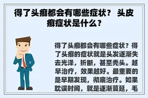 得了头癣都会有哪些症状？ 头皮癣症状是什么？