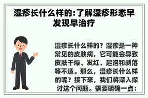 湿疹长什么样的:了解湿疹形态早发现早治疗