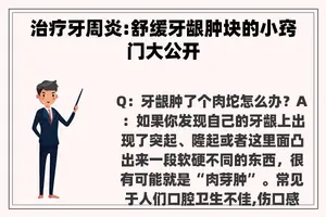 治疗牙周炎:舒缓牙龈肿块的小窍门大公开