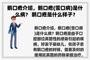 鹅口疮介绍，鹅口疮(雪口病)是什么病？ 鹅口疮是什么样子？