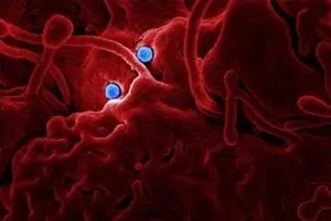 扼住前列腺大，畅享健康人生！