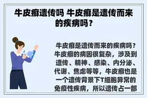 牛皮癣遗传吗 牛皮癣是遗传而来的疾病吗？