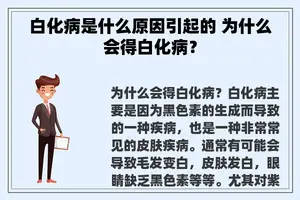 白化病是什么原因引起的 为什么会得白化病？