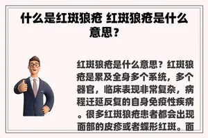 什么是红斑狼疮 红斑狼疮是什么意思？