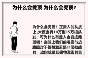 为什么会秃顶 为什么会秃顶？