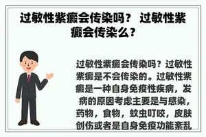 过敏性紫癜会传染吗？ 过敏性紫癜会传染么？