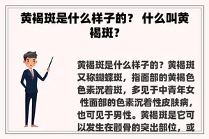 黄褐斑是什么样子的？ 什么叫黄褐斑？