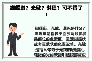 蝴蝶斑？光敏？淋巴？可不得了！