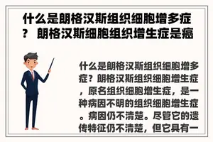 什么是朗格汉斯组织细胞增多症？ 朗格汉斯细胞组织增生症是癌症吗？