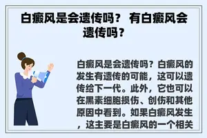 白癜风是会遗传吗？ 有白癜风会遗传吗？