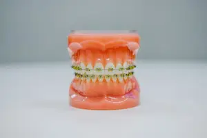 不要让牙结石折磨你，自己动手抠掉！