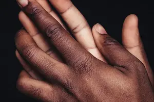 轻松拥有美丽肌肤，光动力治疗收费超划算！