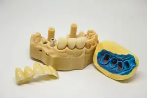 轻松解决晚上磨牙困扰