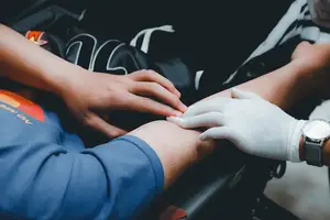 迅速了解湿疹症状,有效治疗方法 迅速了解湿疹症状,有效治疗方法