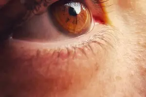近视手术,激光除镜!全程无痛,一次性付费! 近视手术,激光除镜!全程无痛,一次性付费!