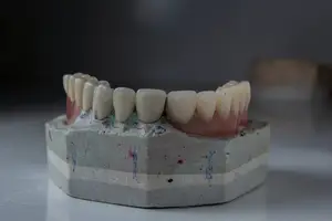 远离多齿症,畅享健康笑容! 远离多齿症,畅享健康笑容!