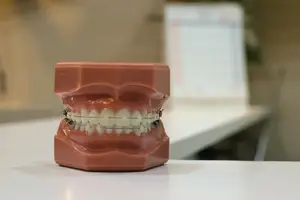 再见牙缝！神奇技术轻松让笑容完美！