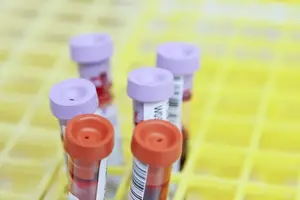 戴眼镜不是导致眼球突出的唯一原因 戴眼镜不是导致眼球突出的唯一原因