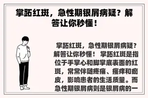 掌跖红斑，急性期银屑病疑？解答让你秒懂！