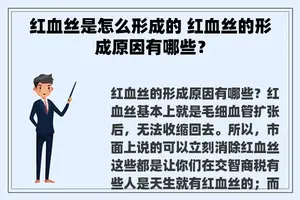 红血丝是怎么形成的 红血丝的形成原因有哪些？