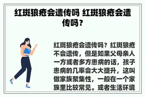 红斑狼疮会遗传吗 红斑狼疮会遗传吗？